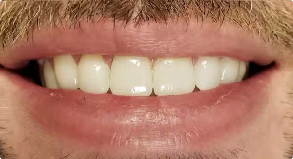 The image shows a close-up of a person s face with a focus on their teeth and lips, which are in sharp contrast against the darker background.